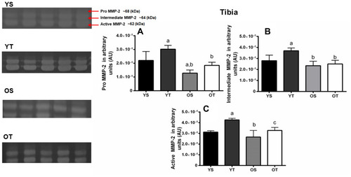 Figure 4 Optical densitometry of zymography bands of MMP-2 in the right tibia. Activity was expressed in arbitrary units (AU). Values are presented as means ± SD. (A) Pro-MMP-2 (68 kDa). (B) Intermediate MMP-2 (64 kDa). (C) Active MMP-2 (62 kDa). The experimental groups were: young sedentary (YS) young trained, (YT) old sedentary (OS), and old trained (OT). Statistically significant differences compared to: aYS; bYT; cOS, p≤0.05 (n=5 per group).