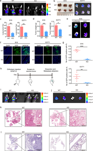 Figure 1. S100A10 deficiency prevents lung metastasis.