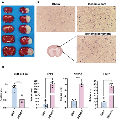 Figure 8 Validation of critical genes and miRNAs in the MCAO/R model. (A) TTC staining of rat MCAO/R model. (B) HE staining of rat MCAO/R model. (C) RT-PCR verification of sham and MCAO/R model. Mean ± SEM, n = 6, ****p < 0.0001, vs Sham group.