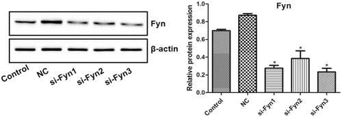Figure 2. The Fyn expression in OLs transfected with three Fyn siRNAs (si-Fyn1/2/3) and Fyn siRNA NC which was evaluated by western blot. *p < .05 vs. Control.