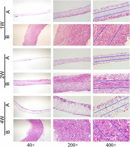 Figure 9. HE staining results of vascular membranes in group A and group B