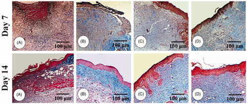Figure 5. Cross section from wound area: (A) NCG group, (B) MG group, (C and D) 2 and 4% ZMEO-treated groups. See well re-epithelialization in ZMEO-treated animals. The re-epithelialization initiated on day 7 after wound induction in ZMEO-treated animals. However, the cross sections from NCG and MG groups are not representing epithelialization. Note well-organized dermis and complete epithelialization with well-formed papillae in ZMEO-treated animals in comparison to NCG and MG groups. Masson-trichrome staining, 100×.