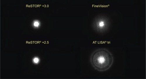 Figure 5 Simulated headlight images through the AT LISA® tri, FineVision®, ReSTOR® +2.5 D, and ReSTOR® +3.0 D IOLs.