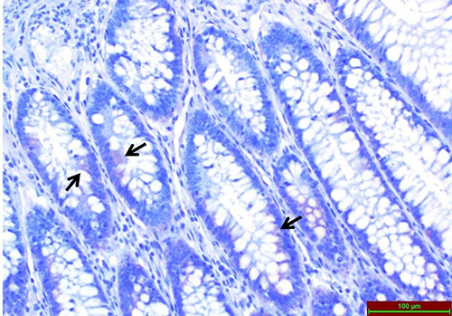 Figure 1 Light microscopic examination of TRPA1 immunoreactivity immunohistochemical staining in normal colon tissues. Arrows indicate areas of immunohistochemical staining.
