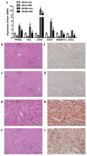 Figure 2. Overexpression of miR-455 improved the liver lipid metabolism. (a) The mRNA expression of PPARγ, FAS, CD36, SCD-1,SREBP-1c and ACCα in the liver of mice in four groups. H&E (b–e) and oil red O staining (f–i) of liver in four groups. Db/m-con group (b + f), db/m-455 group (c + g), db/db-con group (d + h), db/db-455 group (e + i). Magnification ×400. n = 6–8 per group. **P < 0.01 and ***P < 0.001 vs db/m-con group; #P < 0.05 vs db/db-con group