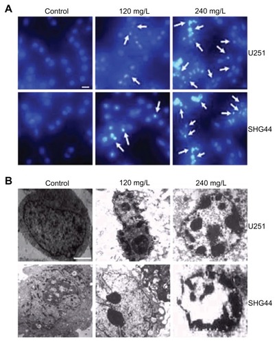 Figure 2 Effect of HAP nanoparticles on the morphologic changes of cells. (A) Hoechst 33342 staining. The apoptotic cells were marked by green fluorescence; scale bar, 20 μm. (B) Transmission electron microscopy.Notes: Original magnification × 6000; scale bar, 1 μm.Abbreviations: HAP, hydroxyapatite; SHG44, human glioma SHG44 cells; U251, human glioma U251 cell.