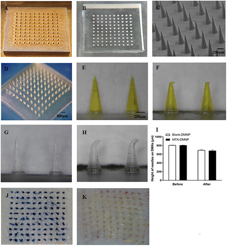 Figure 3. Photographs of microneedle master mold (A) and PDMS female mold (B), scanning electron microscopy (SEM) image (C), and the microscope images (D and E) of MTX-loaded DMNPs, the microscope image of MTX-loaded DMNP after compression (F), the microscope images of blank DMNP before (G) and after (H) compression. The height of DMNPs before and after compression (I). Image of isolated rat skin penetrated by TB-loaded DMNP (J), Data are presented as the mean ± SD (n = 5). In vivo insertion study in rats using MTX-loaded DMNP (K).