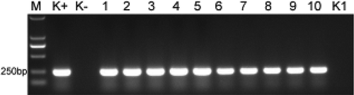 Fig. 3 Confirmation of the infection of banana plantlets by Foc TR4 based on a PCR assay. M: DL2000 marker; K+: Foc TR4 genomic DNA; K−: DNA extracted from the roots of sterilized ‘Brazil’ plantlets; Lanes 1–5: DNA extracted from the roots of five infected ‘Brazil’ plantlets; Lanes 6–10: DNA extracted from the roots of five infected ‘Formosana’ plantlets; K1: H2O.