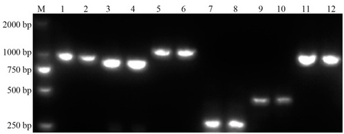 Figure 1 The PCR results of different genes involved in drug resistance in 30 carbapenems-resistance strains of K. pneumoniae.