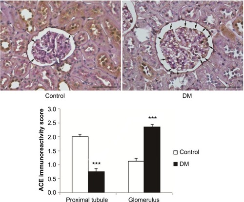 Figure 7 The expression of ACE in normal and diabetic rats.