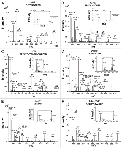 Figure 3 MS and MS/MS spectra of selected differentially expressed proteins. MS and MS/MS spectra of peptide from representative differentially expressed proteins identified in this study. (A) Matrix metalloproteinase 1 (MMP1); (B) TGFbeta induced, 68 KD (TGFBI); (C) GDP dissociation inhibitor 2 (GDI2); (D) Protein disulfide isomerase A3 (PDIA3); (E) Nicotinamide phosphoribosyltransferase (NAMPT) and (F) Lectin, galactoside-binding, soluble, 3 binding protein (LGALS3BP).