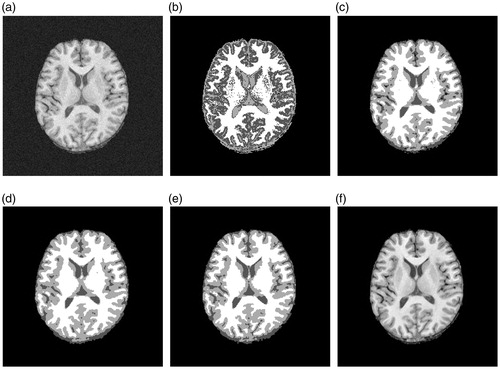 Figure 9. Experiment on own real MRI image: (a) MRI image with noise. (b) FCM result. (c) FGFCM result. (d) FLICM result. (e) Proposed method result. (f) Original MRI image without noise.
