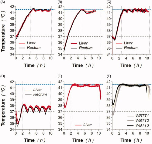Figure 3. Animal body temperatures monitored during whole-body thermal treatment (WBTT) or normothermia procedures. (A) MP1: individual liver (red lines) and rectal (black line) sensor-monitored animal temperatures were recorded during the WBTT procedure (41.5 °C for 6 h). (B) MP2: individual liver (red lines) and rectal (black line) sensor-monitored animal temperatures were recorded during the WBTT procedure (41.5 °C for 6 h). (C) MP3: individual liver (red lines) and rectal (black line) sensor-monitored animal temperatures were recorded during the WBTT procedure (41.5 °C for 8 h). (D) MP4: individual liver (red lines) and rectal (black line) sensor-monitored animal temperatures were recorded during the whole-body normothermia procedure (37 °C for 8 h). (E) MP5: individual liver (red lines) sensor-monitored animal temperatures were recorded during the first WBTT session (41.5 °C for 8 h). (F) MP5: individual liver sensor-monitored animal temperatures were recorded during either the first (light gray lines), second (dark gray lines), or third (black lines) WBTT session (41.5 °C for 8 h).