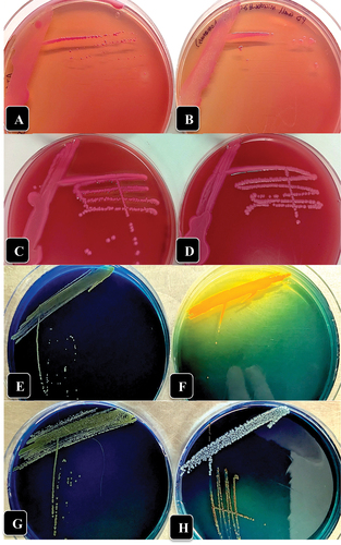 Fig. 3 (Colour online) Growth of three bacterial genera recovered from crown gall tissues in this study on McConkey agar (a-d) and D1 medium (e-h) compared to A. tumefaciens showing colony appearance after 72 hr of incubation at 23°C. (a) A. tumefaciens ATCC 15955. (b) Pseudomonas migulae. (c) Enterobacter sp. (d) Kluyvera cryocrescens. (e) A. tumefaciens ATCC 15955. (f) Enterobacter sp. (g) Pseudomonas migulae. (h) Kluyvera cryocrescens.