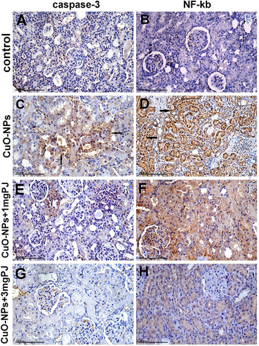 Figure 7 Immunohistochemical expression of caspase-3 and NF-ĸB protein in the kidney tissue sections in different groups showing (A and B) mild to negative caspase-3 and NF-ĸB protein expression in control negative group. (C and D) Moderate positive caspase-3 and extensive nuclear translocation of NF-ĸB protein within the renal tubular epithelial cells in the group intoxicated with CuO-NPs. (E and F) Mild to moderate positive caspase-3 and NF-ĸB protein expression in group pretreated with 1 mL/ kg bwt PJ. (G and H) Mild to negative caspase-3 and NF-ĸB protein expression in group treated with 3 mL/kg bwt PJ.