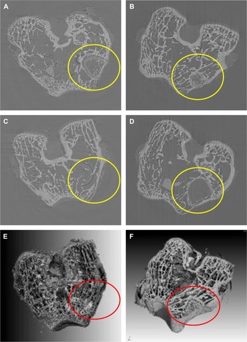 Figure 8 SRmCT images of central virtual slice of MWC and WP scaffolds and cross-section of 3D reconstruction SRmCT images of MWC and WP scaffolds.Notes: SRmCT images of central virtual slice of MWC scaffolds implanted into the femoral defects (yellow circle) of rabbits for 4 (A), 8 (B), and 12 (C) weeks and WP scaffolds implantation for 12 (D) weeks. Cross-section of 3D reconstruction SRmCT images of MWC scaffolds (E) and WP (F) scaffolds implanted into the femoral defects of rabbits for 12 weeks, and the red circles describe the defects.Abbreviations: 3D, three dimensional; MWC, nano magnesium phosphate/wheat protein composite; SRmCT, synchrotron radiation microcomputed tomography; WP, wheat protein.