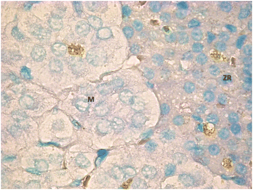 Figure 10. TUNEL positive cells in both adrenal cortex (zona reticularis) and medulla from an animal of G2.