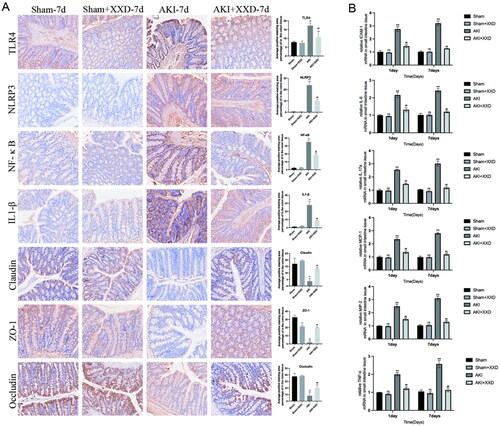 Figure 6. (A) Expression of intestinal barrier markers (claudin-1, occludin, and ZO-l) and TLR4/NF-κB/NLRP3/IL1-β (IHC staining ×200); (B) mRNA expression of IL-6, TNF-α, IL-17A, ICAM-1, MCP-1, and MIP-2 in the colon tissue of rat in each treatment group (nsp > .05 vs. sham group; **p < .01 vs. sham group; ##p < .01 vs. AKI group).