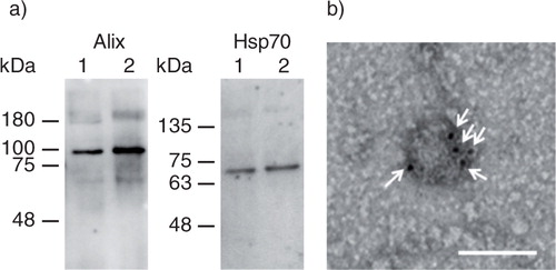 Fig. 1.  Collection of gLuc-LA labelled exosomes. (a) Western blotting analysis of exosomes. Alix and Hsp70, exosome marker proteins, were detected by using Alix- and Hsp70-specific antibodies, respectively. Lane 1: gLuc-LA-labelled B16BL6 exosomes. Lane 2: B16BL6 exosomes. (b) Detection of gLuc on the surface of exosomes collected from B16BL6 cells transfected with gLuc-LA-expressing plasmid DNA. gLuc-LA-labelled B16BL6 exosomes were stained with protein A-gold nanoparticles after reaction with anti-gLuc antibody. The samples were observed by transmission electron microscopy. White arrows indicate gold nanoparticles. Scale bar = 100 nm.