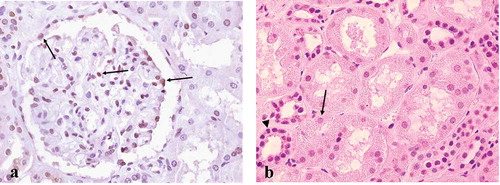 Figure 2.  Sp1 expression in normal human kidney. (a) About 40% of cells within the glomerulus were Sp1-positive, including podocytes, mesangial, endothelial, as well as parietal epithelial cells (arrows). (b) Proximal tubular cells (arrow) were either negative or weakly stained, while distal (arrowhead) and collecting tubules were constantly Sp1 positive. Original magnification ×400.