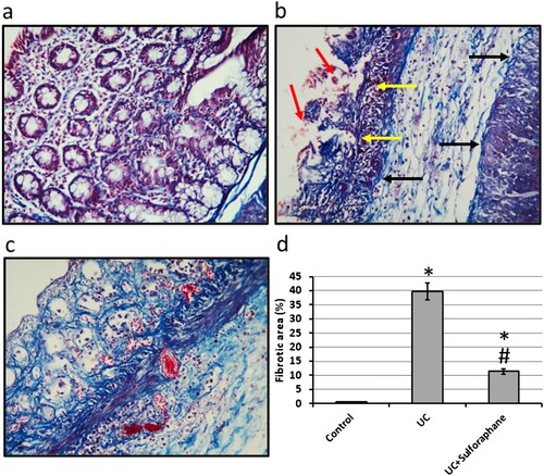 Figure 2. Colon sections stained with Masson trichrome in control group (a), ulcerative colitis (UC, b) and UC treated with 15 mg/kg sulforaphane (c). Examination of UC group revealed damaged intestinal glands (yellow arrows), severe hemorrhage (red arrows) and extensive fibrosis (black arrows). The fibrotic area was calculated for each group (d). The micro-images represented the results of examining three rats in each group with examination of 10 fields in each rat. *Significant difference as compared with control group at p < .05. #Significant difference as compared with UC group at p < .05.