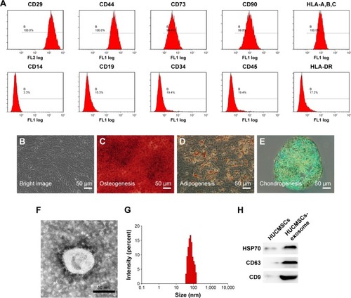 Figure 1 Identification of human umbilical cord mesenchymal stem cells (HUCMSCs) and HUCMSCs-derived exosomes.Notes: (A) Flow cytometric analysis of the expression of cell surface markers related to HUCMSCs. (B) Bright image of HUCMSCs under a light microscope. (C) Representative image of osteocyte differentiation of HUCMSCs by using cytochemical staining with Alizarin Red. (D) Representative image of adiocyte differentiation of HUCMSCs by using cytochemical staining with Oil Red O. (E) Representative image of chondrocyte differentiation of HUCMSCs by using cytochemical staining with Alcian Blue. (F) Transmission electron microscopic image of HUCMSCs-exosome. (G) The size distribution of the HUCMSCs-exosome was analyzed by using a Zetasizer Nano ZS. (H) The positive markers for exosomes, HSP70, CD63, and CD9 were detected by using Western blotting.