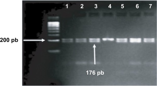 Figure 1 Gel electrophoresis of c.-1031G>A polymorphism.