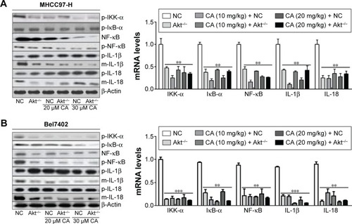 Figure 7 The effect of carnosic acid on NF-κB pathway in Akt-deficient liver cancer cells.Notes: (A) Western blot analysis for the expression of NF-κB pathway (right), and mRNA levels were detected via RT-PCR (left) in MHCC97-H cells. (B) Western blot analysis for the expression of NF-κB pathway (right), and mRNA levels were detected via RT-PCR (left) in Bel7402 cells. Data are expressed as the mean ± standard error of the mean, **P<0.01, ***P<0.001 versus NC group.Abbreviations: RT-PCR, reverse transcription-polymerase chain reaction; NC, negative control.