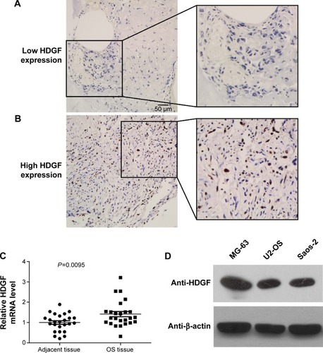 Figure 1 HDGF expression in OS tissues and cells.