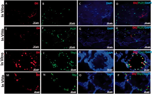 Figure 9. Representative immunohistostaining of SSCs markers in testis section 2 weeks after in vivo cells transplantation and 3D organ culture DiI fluorescent-labelled cells were traced in the recipient testes by fluorescent red light. Images (A, E, I and M) show that the DiI positive cells are localized at the base of seminiferous tubules and have gained homing. The host testis sections were immunostained by the antibodies for Plzf and Thy1 (green) (B, F, J and N). DAPI was used for nuclei staining. (C, G, K and O). The co-localization Plzf and Thy1with DiI labelled iPSCs (D, H, L and P) around seminiferous tubules in recipient testes transplanted is shown by fluorescent microscope.