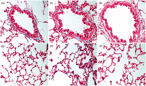 Figure 5. (A–F) Lung tissue sections stained with Masson’s Trichrome in order to visualize fibrin (red stain) and collagen deposition (blue stain) in small-bronchial regions (top panel C and E) and alveolar regions (lower panel, D and F) of rats subjected to ammonia (1% NH3) via intratracheal instillation evaluated in comparison to (A,B) healthy controls. Representative sections are shown from (C,D) 5 h and (E,F) 24 h post-exposure. Photos were taken at 100× magnification using light microscopy. The figure shows representative tissue sections from each group of 4 animals.