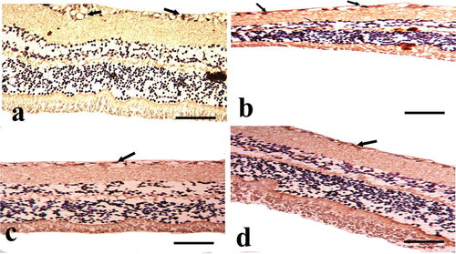 Figure 5. A photomicrograph of the cross section of the rat retina in the experimental groups (anti-CD57 immunostained). A: the CONT group demonstrates modest positive expression (black arrow), particularly in the nerve fiber layer (NFL) and ganglion cell layer (GCL). B: the STZ group demonstrates strong positive expression (black arrow), particularly in the NFL and GCL. C: the STZ+MTF group demonstrates considerable positive expression (black arrow), particularly in the NFL and GCL. D: the STZ+ MTF-NE group has moderate CD57 positive expression (black arrow), particularly in the NFL and GCL. (Scale bar: 50µm).