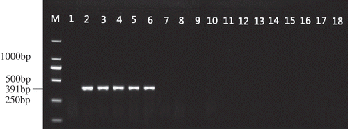 Fig. 5 Allele-specific PCR amplification products from genomic DNA extracted from false smut balls. M, 2-kb DNA ladder (Takara Bio); lane 1, negative control; lanes 2–6, false smut balls derived from tebuconazole-resistant mutants; lanes 7–18, false smut balls derived from tebuconazole-sensitive isolates.