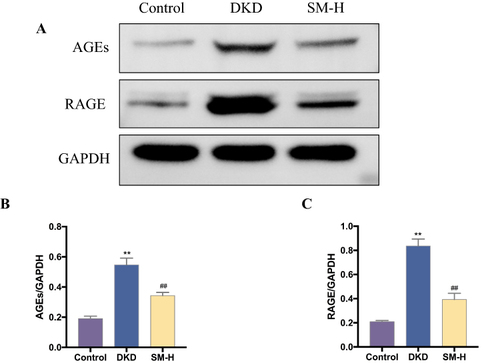 Figure 12 SM inhibits AGEs-RAGE pathway in DKD rats. (A) Representative bands of AGEs and RAGE proteins detected by Western blot. (B) Relative protein levels of AGEs in each group of rats; (C) relative protein levels of RAGE in each group of rats. Data are expressed as mean ± SD (n = 3). ** P < 0.01, compared with the normal group; ## P < 0.01, compared with the DKD group.