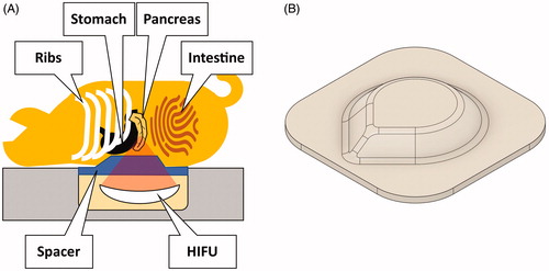 Figure 1. (A) Experimental setup. The pigs were positioned on the patient table in prone position. The abdomen was compressed using a custom-made hydrogel spacer (B) inserted between the animal and the table’s acoustic membrane.