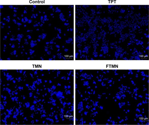 Figure 6 Hoechst 33342 based nuclear staining of Y79 cancer cells. The assay was performed by fluorescence microscopy.