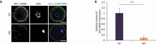 Figure 5. BC1 interacts with FMRP protein in the GV oocyte