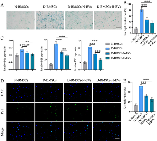 Figure 7 H-EVs pretreatment alleviate the senescence of diabetic BMSCs. (A) Representative images of senescence-associated β-galactosidase-(SA β-gal) staining (Scale bar: 100 μm). (B) quantitative analysis of β-gal-positive BMSCs (n = 6). (C) Expression of senescence-related genes, including P16, P21 and P53, was detected by PCR (n = 6). (D) The level of OPN in MSCs was examined using immunofluorescence staining. (E) Quantitative analysis of the proportion of P21-positive cells (n = 5, scale bar: 100 μm).