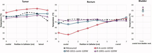 Figure 5. Comparison of measured [for the Higher-Power-Therapy (HP_THER), black dashed curve with cross symbols] and calculated ‘Temperature Sets’ of the pelvic region along the tumor, rectal, and bladder catheters in 14 points: 5 in tumor catheter (0 cm corresponds to the caudal-medial catheter tip), 8 in rectal catheter (0 cm corresponds to anus), and one in bladder catheter, and Calculated results refer to the optimum Parametrized Treatment Models (PTMs) for each ‘Perfusion Behavior Type’ (PBT), respectively. These PTMs are indicated as follows: •‘H-4-centr-105 W’ (red, circle symbols) [homogeneous perfusion model H-4, central patient positioning (CE_POS), absorbed power in the patient model P = 105W]. •‘ND-1011-centr-120W’ (blue, square symbols) (non-dynamic perfusion model ND-1011, CE_POS, P = 120W), and, • ‘D-1001-centr-120W’ (purple, triangle symbols) (dynamic perfusion model D-1001, CE_POS, P = 120W). Region perfusion values are displayed in Table 5.