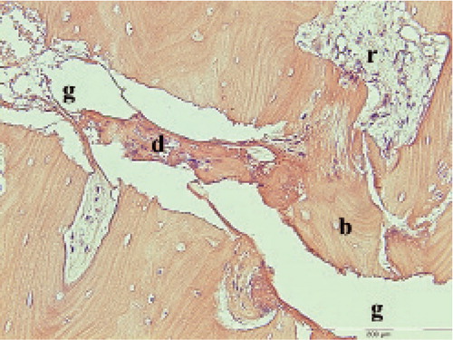 Figure 9. Incomplete fracture. g fracture gap. b bone fragments about to break off. d cellular remnants. r resorption cavity almost reaching into the fracture gap.