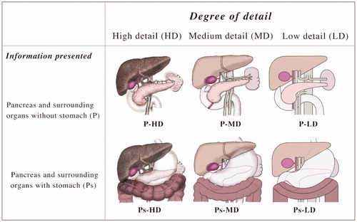 Figure 1. Pancreatic cancer illustrations that vary in the degree of detail.