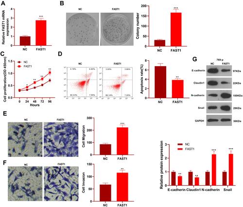 Figure 2 Overexpressing FAST1 aggravated the malignant biological behaviors of RC and inhibited apoptosis. The 769-P cell lines were transfected with the FAST1 overexpressing plasmids. (A) The FAST1 expression was verified by qRT-PCR. (B) Cell colony formation assay was used to examine cell viability. (C) CCK8 was used to test cell proliferation. (D) Flow cytometry was employed to determine apoptosis. (E and F) Cell migration and invasion were testified by the Transwell assay. (G) The expression of EMT-related markers (E-cadherin, Claudin1, N-cadherin and Snail) was detected by WB. *P< 0.05, **P < 0.01, ***P < 0.001 (vs NC group). N=5.