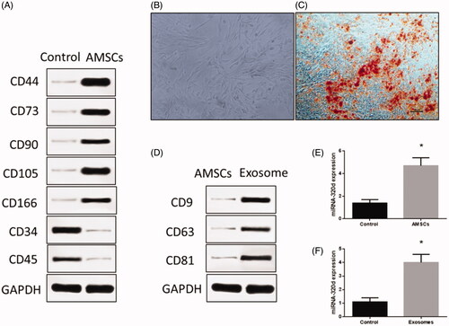 Figure 1. Isolation of adipose tissue-derived mesenchymal stem cells (AMSCs) and exosomes. (A) The AMSCs surface markers detected by western blots. (B) Representative image of AMSCs. (C) Oil Red O staining in cardiomyocyte administered the adipogenesis treatment. Scale bar = 50 μm. (D) The exosome surface markers detected by western blots. (E) miRNA-320d expression in AMSCs. (F) miRNA-320d expression in exosomes. Values are means ± SEM. For each experiment, sample size n ≥ 3. (*) denotes difference from control group (p < .05).