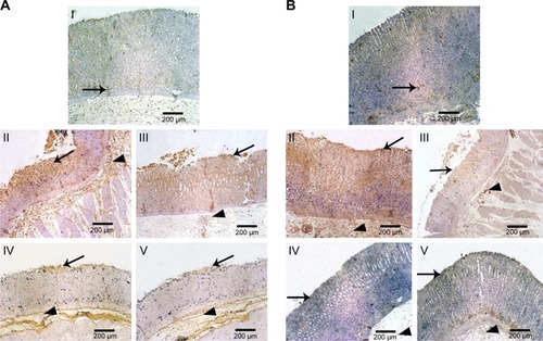 Figure 8 Microphotographs of gastric tissue of rats using immunohistochemical staining for (A) TNF-α and (B) caspase-3 in comparison with normal and positive control groups (IHC, 100×).Notes: (I) Normal control displaying minimal brown-stained gastric mucosal epithelium (arrow), (II) positive control showing intense brown staining in gastric mucosal epithelium (arrow), gastric glands, and submucosa (arrow head), (III) rats orally pretreated with naringin (100 mg/kg) showing moderate brown staining of the gastric mucosal epithelium (arrow), gastric glands, and submucosa (arrow head), and orally pretreated with either (IV) naringin (200 mg/kg) or (V) naringin–PF68 micelles (100 mg/kg) displaying mild brown staining of superficial gastric mucosal epithelium (arrow) and gastric glands and submucosa (arrow head).Abbreviations: IHC, immunohistochemical; PF68, pluronic F68; TNF-α, tumor necrosis factor-alpha.