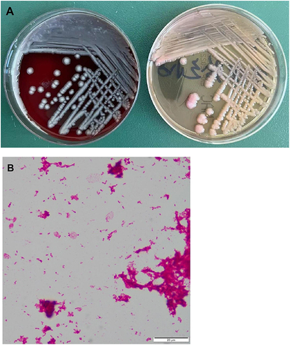 Figure 2 Aetiological examination of multidrug-resistant Klebsiella pneumoniae: (A) colonies; (B) Gram stain.