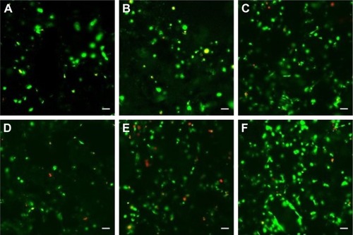 Figure 7 LSCM micrographs of MC3T3-E1 cell (scale bars, 50 μm for all panels) culture in (A) dichloromethane group for 3 days, (D) dichloromethane group for 7 days, (B) mixture group for 3 days, (E) mixture group for 7 days, (C) SF/PLLA 2:8 group for 3 days and (F) SF/PLLA 2:8 group for 7 days (live cells are stained green and dead cells are red).Abbreviations: LSCM, laser scanning confocal microscope; SF, silk fibroin; PLLA, poly(l-lactic acid).