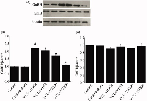 Figure 5. The protein levels of GnRH and GnIH. (A) Western-blot was performed to determine the GnRH and GnIH level in each group. (B) Quantification of GnRH expression. (C) Quantification of GnIH expression. *p < 0.05 vs. VCL-vehicle group, #p < 0.05 vs. Control group.