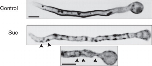 Figure 4. Fluorescent, UapA-GFP specific (alcAp -UapA-GFP), patches correspond to plasma membrane invaginations visible (highlighted with arrow heads) in deconvoluted images obtained with an inverted Leica microscope with motorized z-focus. Maximal intensity projections obtained from z-stacks using the Metamorph 3D are shown (see Experimental section). Two samples treated with sucrose (0.8 M) are shown compared with an untreated control.