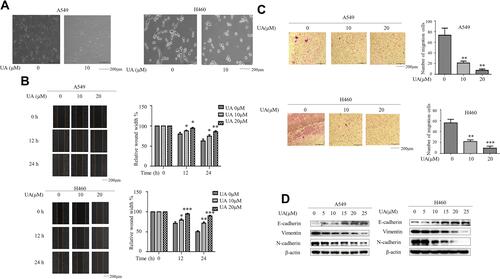 Figure 1 Urolithin A inhibits EMT in lung cancer cells. (A) A549 and H460 cells were exposed to 10 μM urolithin A for 24 h. Cell morphology was assessed by phase-contrast microscopy (magnification 100×), scale bars 200 μm. (B) Wound Healing Assay reveals a dose-dependent (urolithin A 0, 10, 20 μM) (upper panel) and time-dependent (0, 12, 24 h) (lower panel) decrease in cell migration, scale bars represent 200 μm. The quantification was present in right panel. (*P < 0.05, **P < 0.01, ***P < 0.001 for difference from untreated control by ANOVA with Dunnett’s correction for multiple comparisons). (C) A549 and H460 were exposed to different concentrations of urolithin A (0, 10, 20 μM) treatment for 24 h. The cell invasiveness was assessed by Transwell chamber, scale bars indicate 200 μm. (**P < 0.01, ***P < 0.001 for difference from untreated control by ANOVA with Dunnett’s correction for multiple comparisons). (D) A549 and H460 cells were treated with different concentrations of urolithin A (0, 5, 10, 15, 20, 25 μM). Western blot examined epithelial marker E-cadherin, mesenchymal markers N-cadherin, Vimentin.