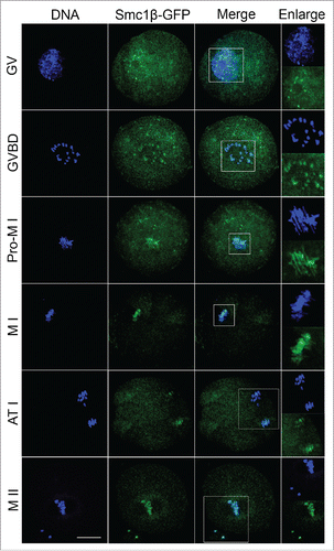 Figure 1. Subcellular localization of Smc1β during mouse oocyte meiotic maturation. Mouse oocytes were microinjected with Smc1β-GFP cRNA at GV stage, and then cultured to GVBD, Pro-MI, MI, ATI and MII stages, respectively, followed by nuclear staining with Hoechst (blue). GV, oocytes at germinal vesicle stage; GVBD, oocytes at germinal vesicle breakdown stage; Pro-MI, oocytes at first prometaphase stage; MI, oocytes at first metaphase stage; ATI, oocytes at first anaphase/telophase stage; MII, oocytes at second metaphase stage. Scale bar, 20 μm.